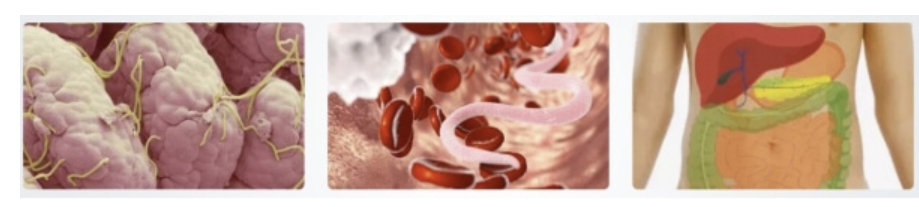 Parazitai – paaiškinimas ir galimi simptomai